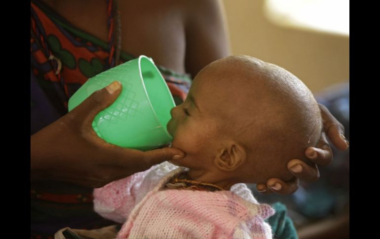 Para superar esa situación, los menores necesitan ser nutridos en primera instancia con alimentos terapéuticos. AP / ARCHIVO