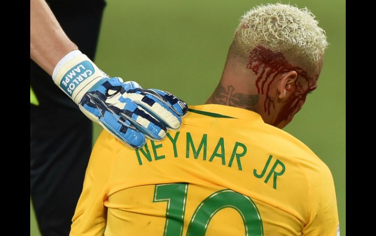 Neymar dio un susto al sangró tras un choque fortuito y fue preservado por Tite al dejar su puesto a los 68 minutos. AFP / N. Almeida