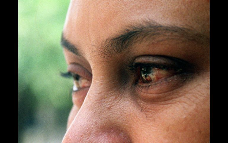 La conjuntivitis es súper común y afecta a tres millones de personas al año. EL INFORMADOR / ARCHIVO