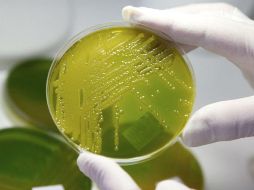 El caso podría representar un hito en los estudios de antibióticos y bacterias. EFE / ARCHIVO