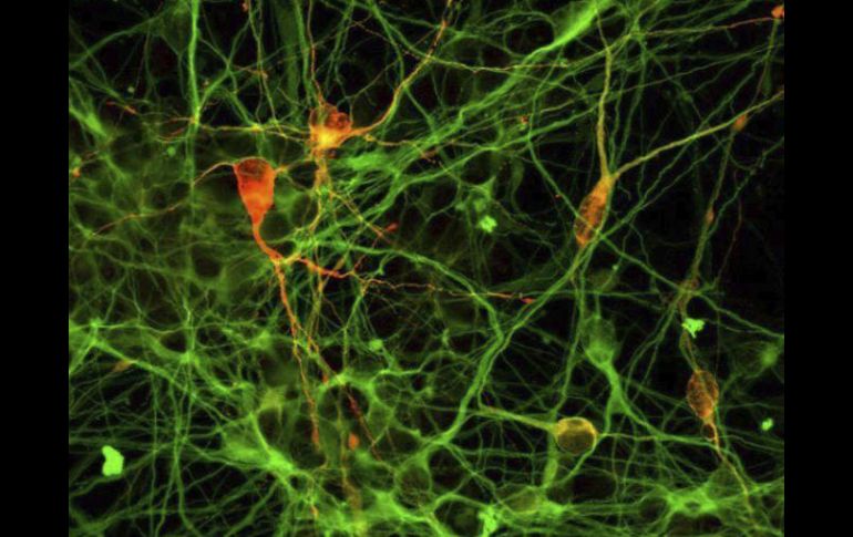 Los resultados demuestran que las neuronas de los enfermos de Huntington no son 100 por cien iguales a las personas sanas. EFE / ARCHIVO