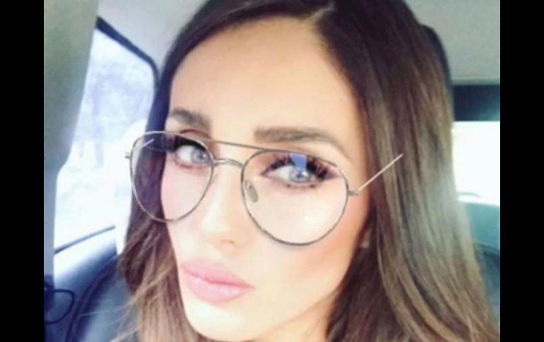 Lo que más llamó la atención fue lo afilado de sus facciones y el grosor de sus labios. INSTAGRAM / anahi