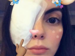 Ximena Navarrete tuvo problemas con ojo y se sometió a cirugía. INSTAGRAM / ximenanr