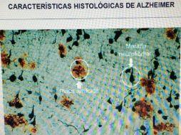 Los investigadores tienen el propósito de ampliar este estudio en un futuro mediante el análisis de un mayor número de muestras. NTX / ARCHIVO