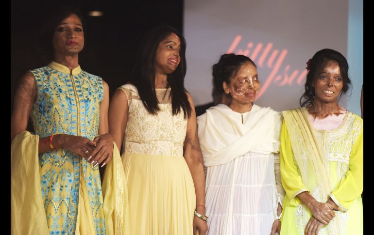 Nueve mujeres que fueron víctimas de ataques con ácido en India se subieron este sábado a una pasarela de moda para un desfile inédito, en el día de la lucha contra la violencia de género. AFP/D. Faget