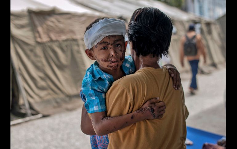Un niño herido se ve con un familiar en un hospital improvisado en Palu, Indonesia, luego del sismo y el tsunami que azotaron la región la semana pasada. AP/F.  Chaniago