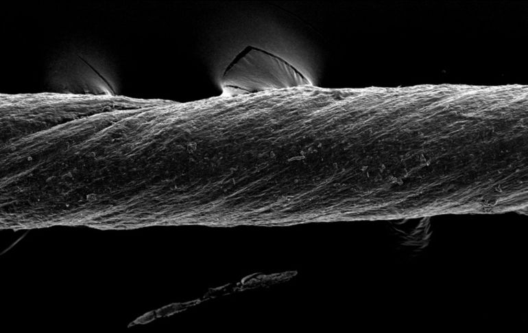 Mediante una capa de hidrogel, las suturas pueden contener micropartículas capaces de detectar inflamaciones, moléculas de fármacos o células vivas. EFE/Imagen cedida por el MIT
