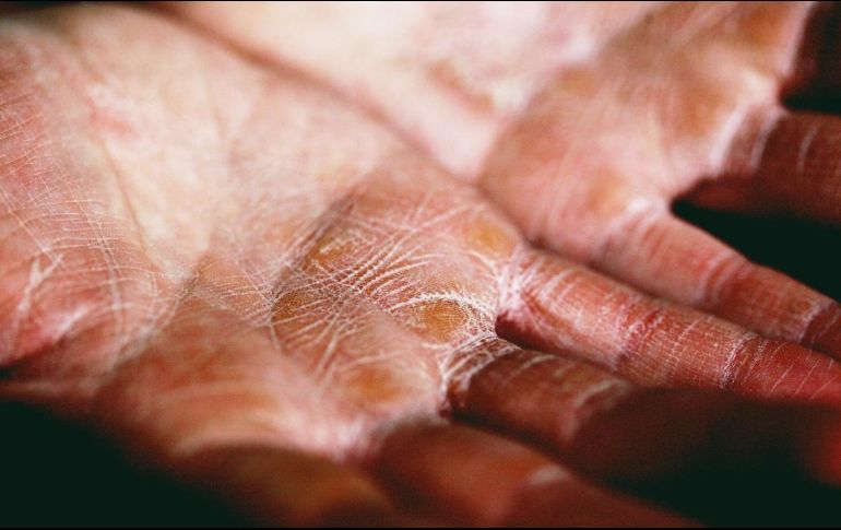 Recuerda que la constancia en el cuidado de tus manos es clave para mantenerlas saludables y libres de lesiones. ESPECIAL/UNSPLASH