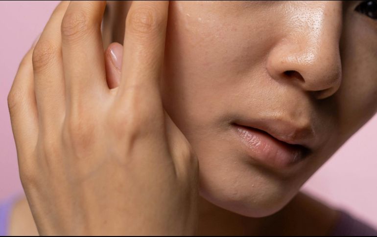 La piel es uno de los órganos que más evidencia el paso del tiempo y síntomas de algunas afecciones. Pexels.