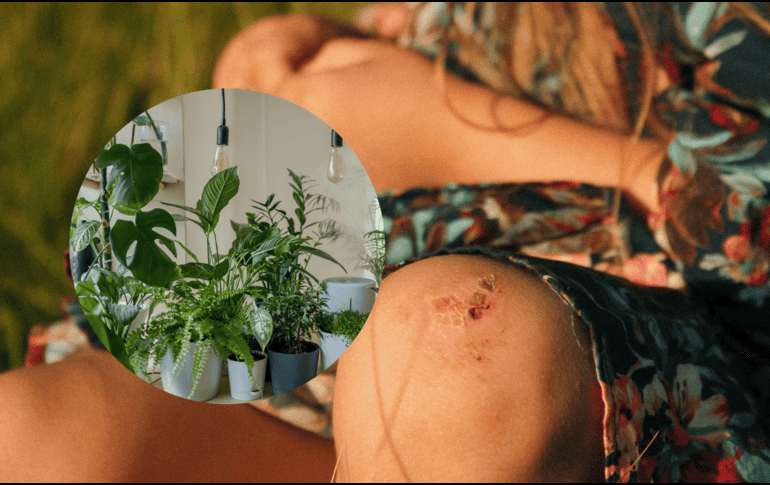 Esta desconocida planta para muchos cuenta con propiedades medicinales capaces de sanar heridas de la piel. UNSPLASH/ Klara Kulikova/ vadim kaipov