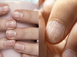 Las estrías en las uñas o uñas rayadas son más comunes de lo que se cree, ¿pero sabes por qué aparecen? Aquí te lo explicamos. ESPECIAL