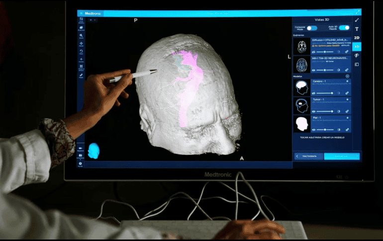 Investigadores de institutos Feinstein de Investigación Médica se propuso averiguar los efectos del sexo y el género en la actividad de las redes cerebrales. EFE/ ARCHIVO