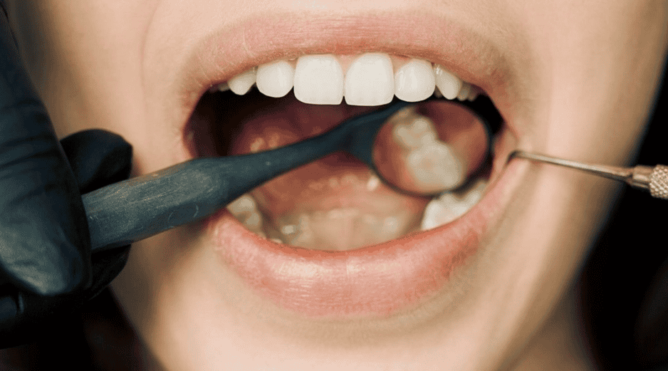 El momento en que decides cepillarte los dientes y tus hábitos diarios juegan un papel crucial en la salud del esmalte dental y el color de tus dientes. CANVA