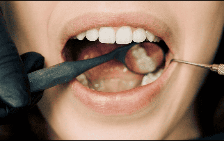 El momento en que decides cepillarte los dientes y tus hábitos diarios juegan un papel crucial en la salud del esmalte dental y el color de tus dientes. CANVA