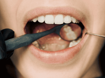 El momento en que decides cepillarte los dientes y tus hábitos diarios juegan un papel crucial en la salud del esmalte dental y el color de tus dientes. CANVA