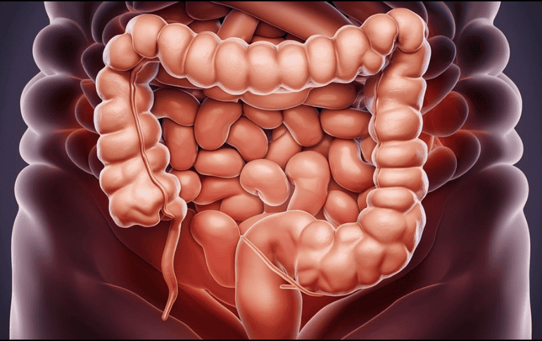 El síndrome del intestino irritable incluye el dolor repetido en el abdomen y cambios en la evacuación de las heces, como diarrea, estreñimiento o ambos. PIXABAY/ ramoninciarte