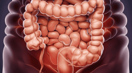 El síndrome del intestino irritable incluye el dolor repetido en el abdomen y cambios en la evacuación de las heces, como diarrea, estreñimiento o ambos. PIXABAY/ ramoninciarte