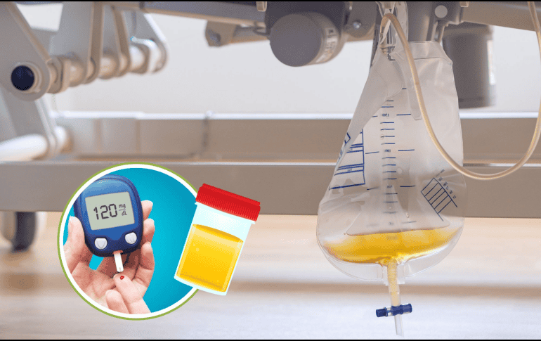 La diabetes insípida es un trastorno que afecta el equilibrio de fluidos en el cuerpo y puede tener un impacto significativo en la calidad de vida si no se maneja adecuadamente. CANVA