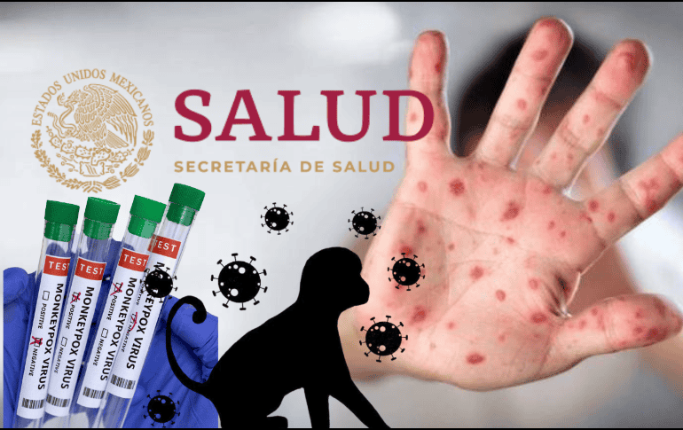 Una nueva alerta de salud preocupa a México: la relacionada con la viruela del mono o mpox, pero ¿Hay casos letales en México? EFE/ ARCHIVO/ ESPECIAL