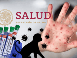 Una nueva alerta de salud preocupa a México: la relacionada con la viruela del mono o mpox, pero ¿Hay casos letales en México? EFE/ ARCHIVO/ ESPECIAL