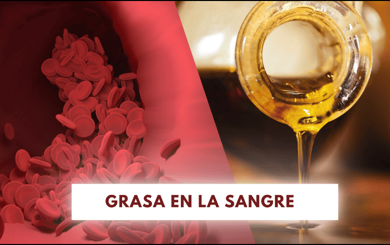 Se le llama hiperlipidemia cuando los niveles de grasa en la sangre son superiores a los adecuados. ESPECIAL/Imagen de congerdesign en Pixabay/Imagen de Narupon Promvichai en Pixabay